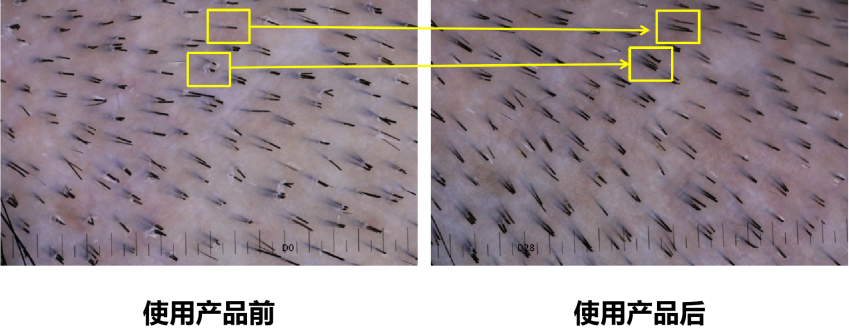 頭皮健康,紅斑,,丘疹,膿皰,評價方法