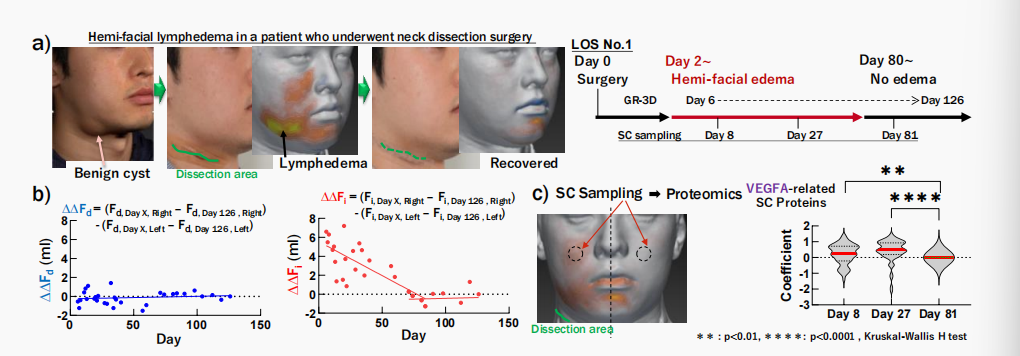 CIRS功效評價,技術實踐,下垂,水腫,定量評估